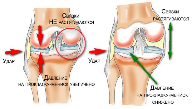 Связка мениска колена. Связки мениска коленного сустава. Строение менисков коленного сустава.